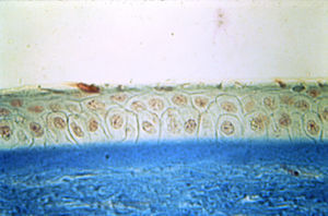 Corte histológico del tercio anterior de la córnea. Tricrómico de Masson. Colección histopatológica de córnea. Fuente: Harvard Medical School Cogan Eye Pathology Lab. Dr. Rogelio Villarreal (1986) - Dr. Iván Vela.