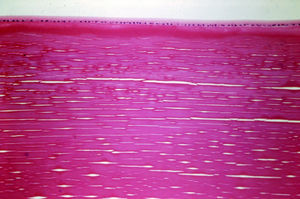 Corte histológico del tercio anterior del cristalino. H&E. Colección histopatológica ocular. Harvard Medical School Fuente: Cogan Eye Pathology Lab. Dr. Rogelio Villarreal (1986) - Dr. Iván Vela.