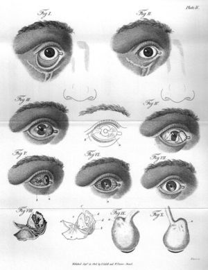 Diversas enfermedades oculares.