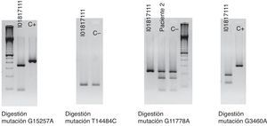 Imagen de la secuenciación en este paciente de la mutación G11778A, siendo negativa para G15257A, T14484C y G3460A.