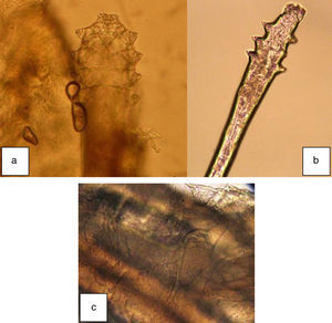 a) Ácaro adulto. b) Larva hexápoda. c) Huevo dentro de cilindro. Autoría de las fotos: Dr. F. Pólit.