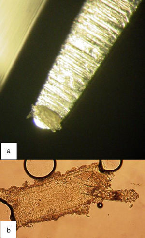 a) Restos de cilindro retirado con pinza fina. b) Ácaro y huevo en restos de un cilindro. Autoría de las fotos: Dr. F. Pólit.
