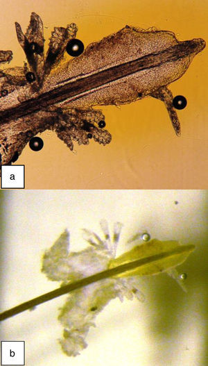 a) Ramillete de ácaros bajo el microscopio de luz. b) Ramillete de ácaros bajo la lámpara de hendidura. Autoría de las fotos: Dr. F. Pólit.