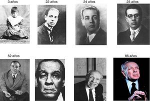 Secuencia cronológica de fotografías de Jorge Luis Borges que muestran las manifestaciones físicas de la oftalmopatía conforme avanza su edad. Destaca la acentuación del estrabismo convergente y de la ptosis palpebral derecha durante la vejez.