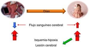 Regulación del flujo sanguíneo cerebral.
