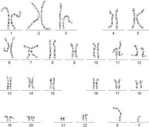 Cariotipo humano. Conjunto normal de cromosomas humanos de origen masculino teñidos con una técnica tradicional de bandeo, incluyendo 22 pares de autosomas (numerados del 1 al 22) y un par de cromosomas sexuales X y Y. Figura tomada del J. Craig Venter Institute.