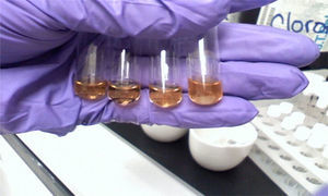 Prueba de bacterias anaerobias.