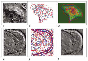 Shape reconstruction. A. LiDAR artifact on a small hill; B. Contour lines; C. Reconstructed hill shape; D. Meander artifact; E. Contour lines; F. Reconstructed meander.
