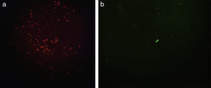 Fluorescent fast acid bacillum in Auramine-Rhodamine stain, (a) red and (b) green light (100×).