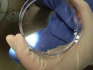 Toma de muestra abundante, lo más homogénea posible, en la placa de Petri.
