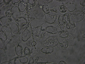 Visualización al microscopio de artroconidias (T. rubrum) en KOH a 40 aumentos (imágenes cedidas por cortesía de Luis Alou).