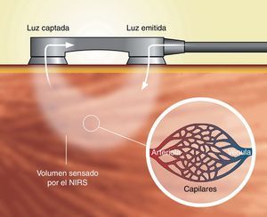 Representación del funcionamiento de la tecnología de la espectroscopia de luz en el espectro cercano al infrarrojo. El sistema consta de una fuente de luz NIRS (habitualmente emitiendo 4 longitudes de onda diferentes), sensores de fibra óptica (optrodos) emisores y receptores, y un procesador que detecta y cuantifica la entrada de fotones en la señal recuperada. La distancia entre los optrodos emisor y receptor determinará la profundidad y el área de sensado del sistema.