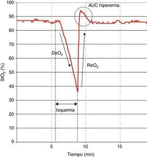 Test de oclusión vascular. La oclusión vascular proximal al sensor de StO2 provoca una caída en los valores de StO2. Al alcanzar un nivel de isquemia predeterminado (por ejemplo, StO2 de 40%), la liberación de la oclusión vascular dará lugar a la reoxigenación del tejido sensado, junto a una respuesta de hiperemia derivada de la vasodilatación postisquémica. AUC: área de hiperemia; DeO2: pendiente de desoxigenación de la saturación tisular de oxígeno; ReO2: pendiente de reoxigenación de la saturación tisular de oxígeno; StO2: saturación tisular de oxígeno; TOV: test de oclusión vascular.