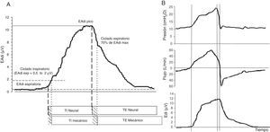 Señal EAdi y curvas respiratorias características durante la ventilación en NAVA. A. Señal EAdi. El inicio de la inspiración viene dado por el aumento en la actividad de la EAdi (primera línea discontinua) partiendo de la actividad espiratoria que en condiciones normales es 0. En el momento en que la EAdi alcanza un valor umbral (primera línea de puntos) el ventilador comienza la asistencia hasta que la EAdi desciende a un 70% del valor máximo (segunda línea de puntos). El tiempo inspiratorio neural comprende el periodo entre las 2 líneas continuas, finalizando cuando la EAdi alcanza su valor máximo. El tiempo ventilatorio mecánico comprende el periodo entre las 2 líneas discontinuas (ciclado inspiratorio y espiratorio). Nótese que, aunque mínimo, existe un desfase en el tiempo entre los tiempos neurales y mecánicos debido a los criterios de ciclado impuestos. En B, las curvas de presión, flujo y EAdi de un ciclo muestran la perfecta sincronía inspiratoria (primera línea discontinua) y el ciclado espiratorio que se produce inmediatamente iniciado el tiempo neural del paciente, en relación con el cese del esfuerzo inspiratorio. Al igual que en PAV, la presurización es gradual y en NAVA sigue la morfología de la fase inspiratoria de la EAdi. El nivel de NAVA es de 1 pudiendo observarse que la presión final inspiratoria alcanzada es de 22cmH2O que corresponde a la EAdi (=12)×nivel NAVA (=1)+el nivel de PEEP (=10). Adaptada de Suárez-Sipmann et al.30.