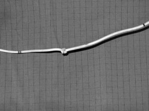 Fotografía del catéter de estimulación cardiaca transitoria con el «nudo» a 15cm de la punta tras su retirada.