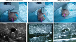 Visualization of the vessel and the puncture needle in the most frequently used ultrasound axes in the training model.