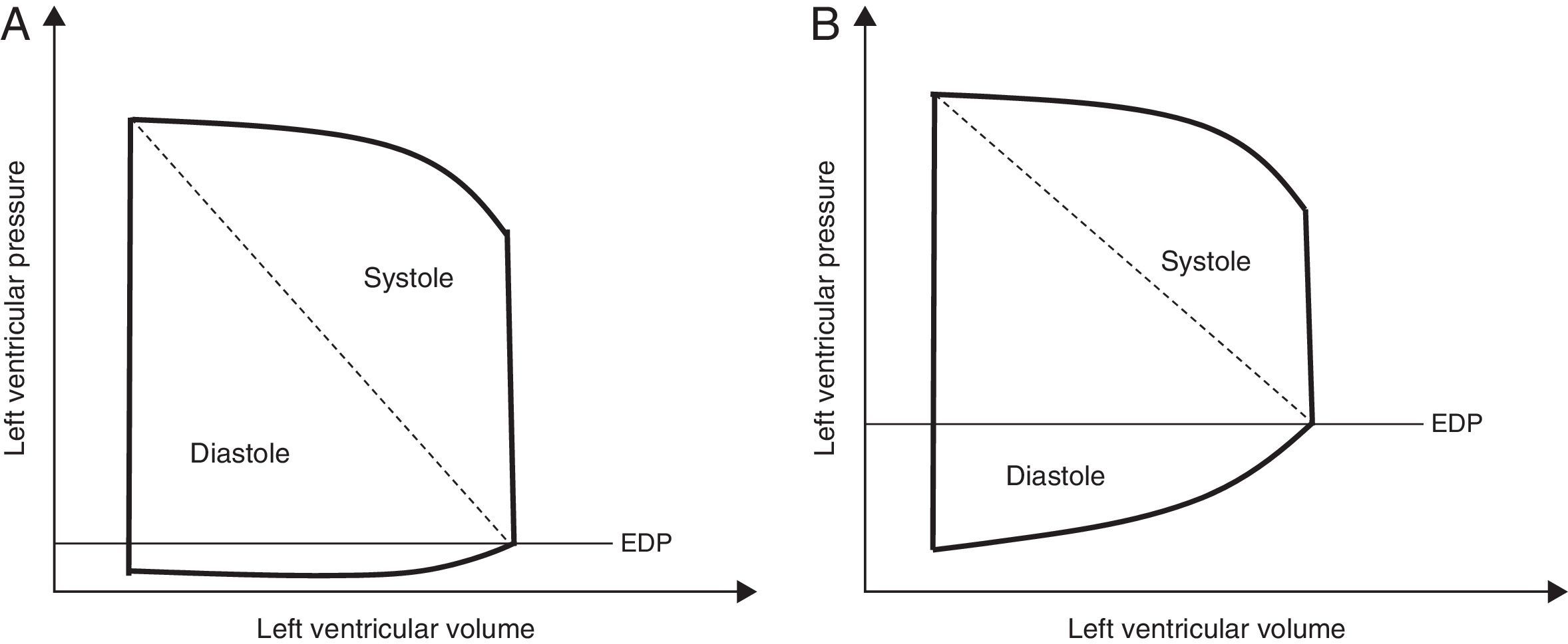 Diastolic dysfunction in the critically ill patient | Medicina Intensiva