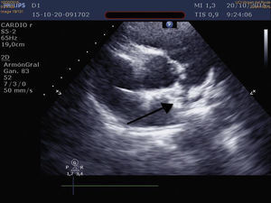 Figura 1