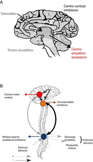 Teorías de desconexión: A. Convencional. B. Modelo excitación-inhibición. Fuente: Baguley25.