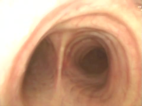 https://ars.els-cdn.com/content/image/1-s2.0-S0210569118302195-mmc2.mp4