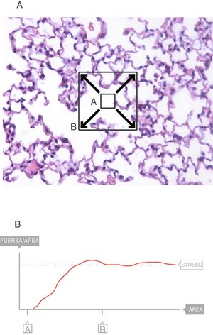 Stress=incremento de presión de retracción (incremento de presión transpulmonar=ΔPTP). Fuente: reproducida con permiso de Modesto-Alapont V, et al.5.