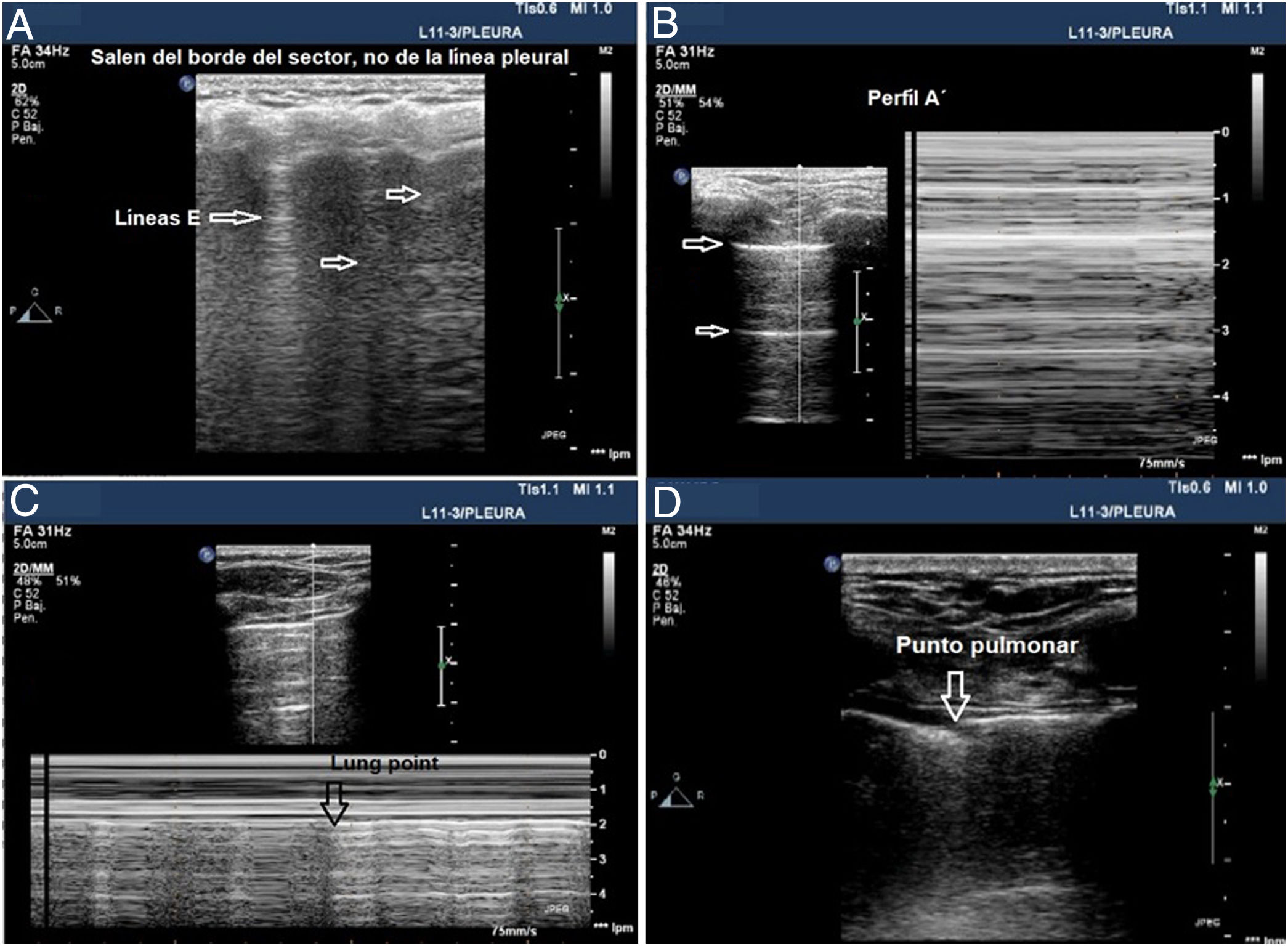 Protocolo de manejo hospitalario de alteraciones electrocardiográficas en  pacientes con COVID-19 con un sistema portátil vinculado a smartphone