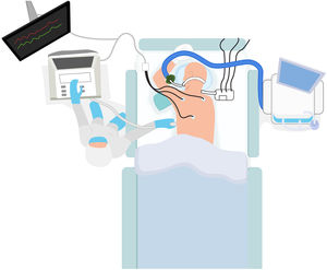 Esquema para estudio de ecocardiografía transtorácica en decúbito prono.