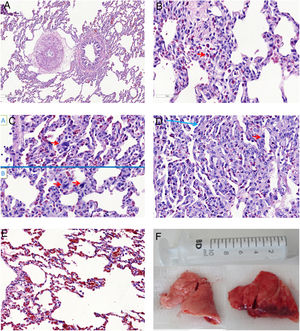 Microscopic aspects of the lungs from SHAM group (A), and the ETX-R (B, C, D, E). (A) normal lung. (B) Neutrophils in interstitium and alveolar wall. (C) Reactive Type II pneumocytes with hyperchromatic nuclei and nuclear membrane irregularity. (D) Thickened alveolar walls with intramural neutrophils, macrophages and fibroblasts. (E) Area with pulmonary emphysema. (F) Gross pathology surface of lung in the SHAM (left) and ETX-R (right) animals. Last one shows more intense damage, especially hemorrhagic areas and lung edema. SHAM: sham-operated group; ETX: non-resuscitated septic group; ETX-R: resuscitated septic group (HE ×40).