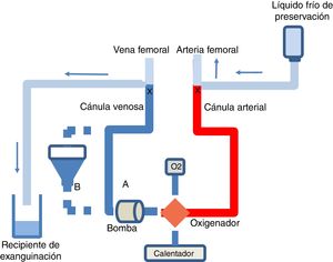 Esquema del circuito de ECMO y del procedimiento de exanguinación en la donación en asistolia controlada. Circuito de ECMO sin (A) o con (B) reservorio, bomba de perfusión, oxigenador, fuente de oxígeno y calentador. Al terminar la PAN-ECMO se pinzan las cánulas arterial y venosa y se perfunde líquido frío de preservación por la cánula arterial, y se usa la venosa para la exanguinación.