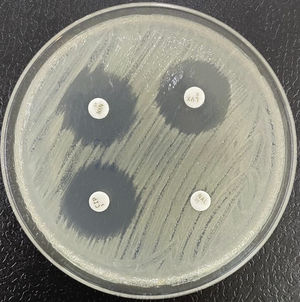 Klebsiella pneumoniae con perfil de bajo nivel de resistencia a quinolonas. Obsérvese la resistencia a ácido nalidíxico (NAL) y la menor afectación de las quinolonas fluoradas, norfloxacino (NXN), levofloxacino (LVX) y ciprofloxacino (CIP).