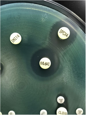 Pseudomonas aeruginosa, expresión inducible de cefalosporinasa AmpC. La asociación con cloxacilina (IPCX4) y/o ácido borónico (IMPBO) devuelve la sensibilidad a imipenem (IMI).
