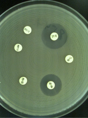 Pseudomonas aeruginosa, aislamiento productor de metalobetalactamasa. La asociación con ácido dipicolínico (DP) y/o EDTA (OE) devuelve la sensibilidad a meropenem (MRP) y/o a imipenem (IMI).