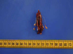 Figura 1