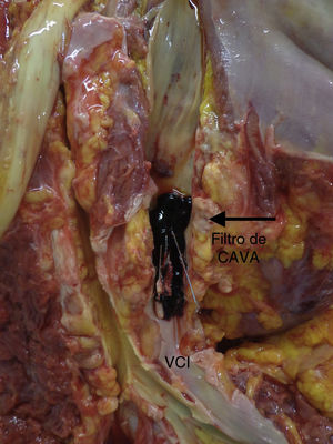 Figura 2