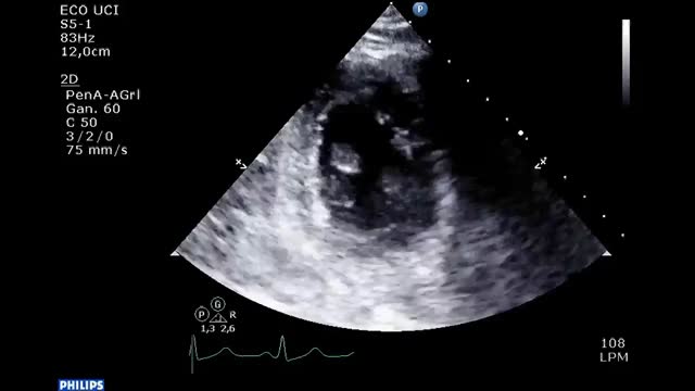 https://ars.els-cdn.com/content/image/1-s2.0-S0210569123003145-mmc4.mp4