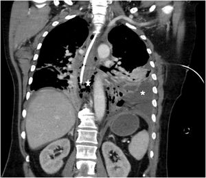 Figura 3