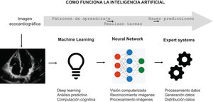 La inteligencia artificial (IA) puede utilizar imágenes/vídeos de ecocardiografía sin procesar para proporcionar automáticamente mediciones estructurales o funcionales, pero también para identificar estados patológicos. El procesamiento de imágenes surge de análisis profundos desde el píxel de una manera repetida. Esto también implica analizar y mejorar la calidad de la imagen para extraer información.
