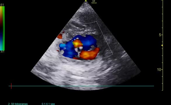 https://ars.els-cdn.com/content/image/1-s2.0-S0210569124002535-mmc1.mp4