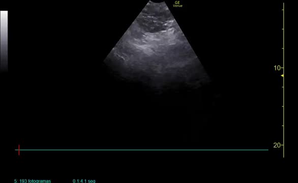 https://ars.els-cdn.com/content/image/1-s2.0-S0210569124002535-mmc3.mp4