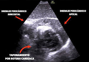 Figura 3