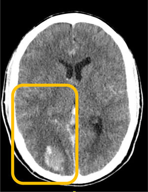 Corte axial.