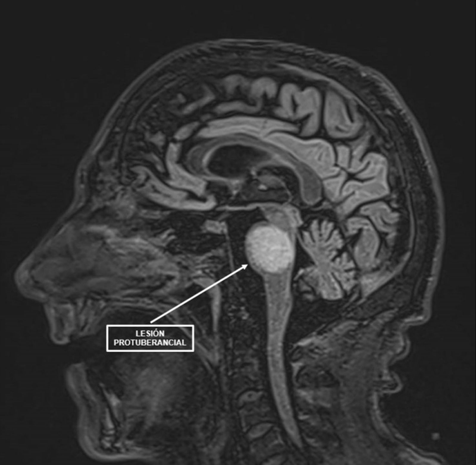 fig0005