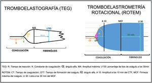 Esquema de tromboelastografía (TEG) y tromboelastometría rotacional (ROTEM).