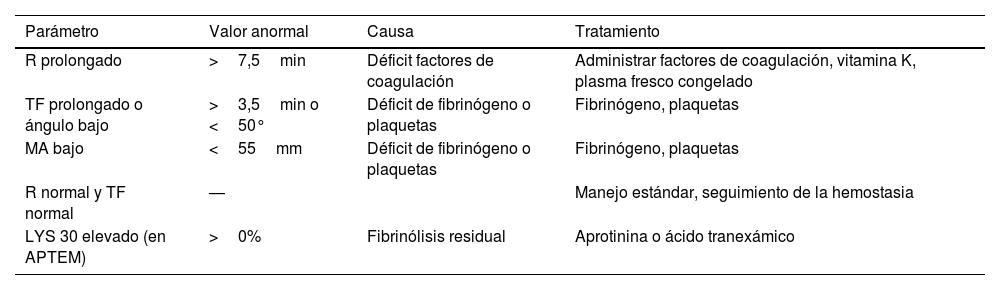 Tablas
