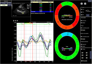Radial velocity (cm/s).