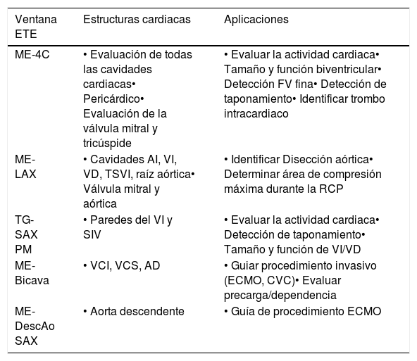 Tablas
