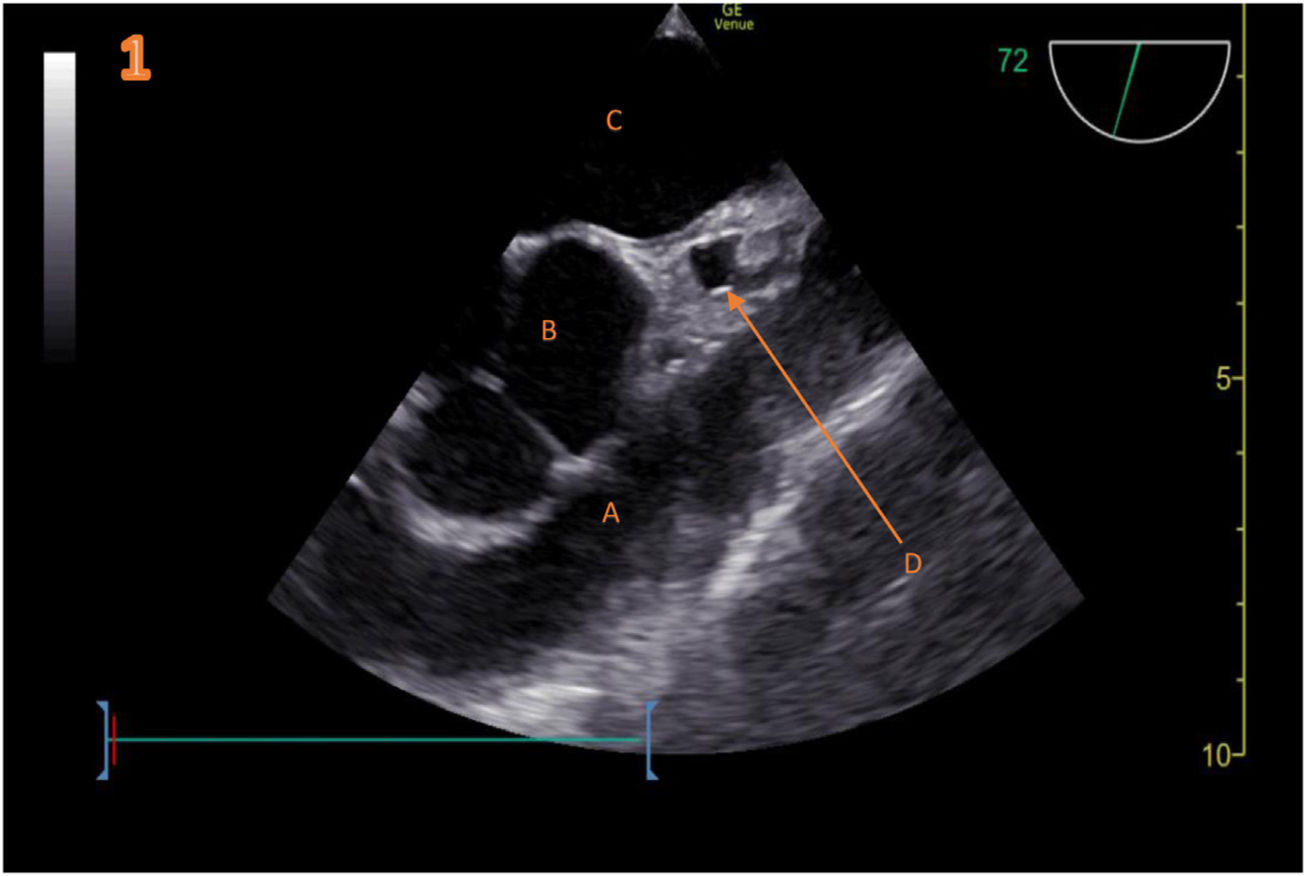 fig0005