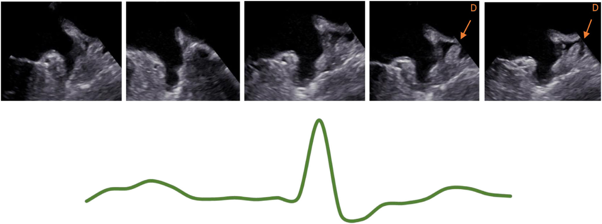 fig0015
