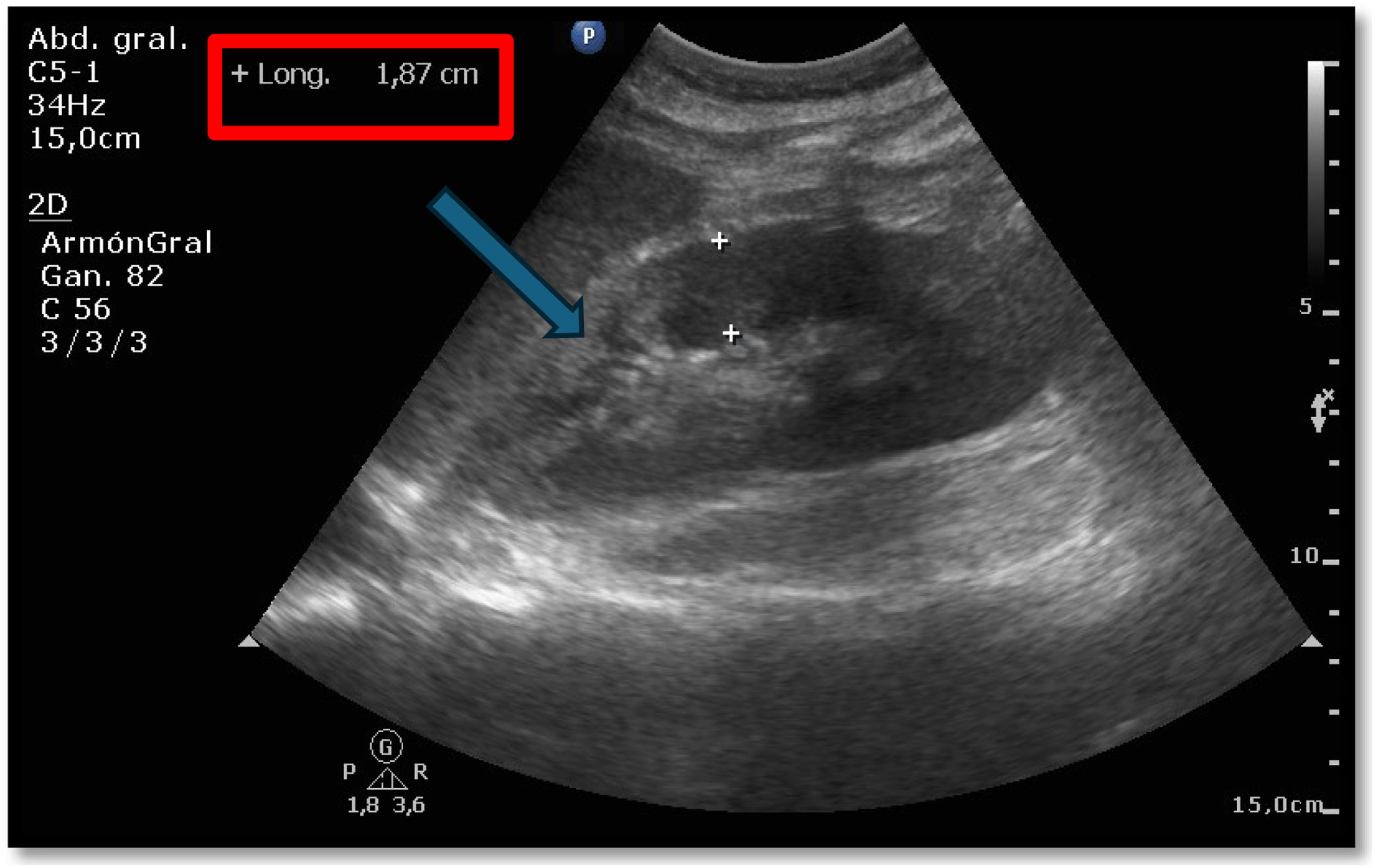 fig0010