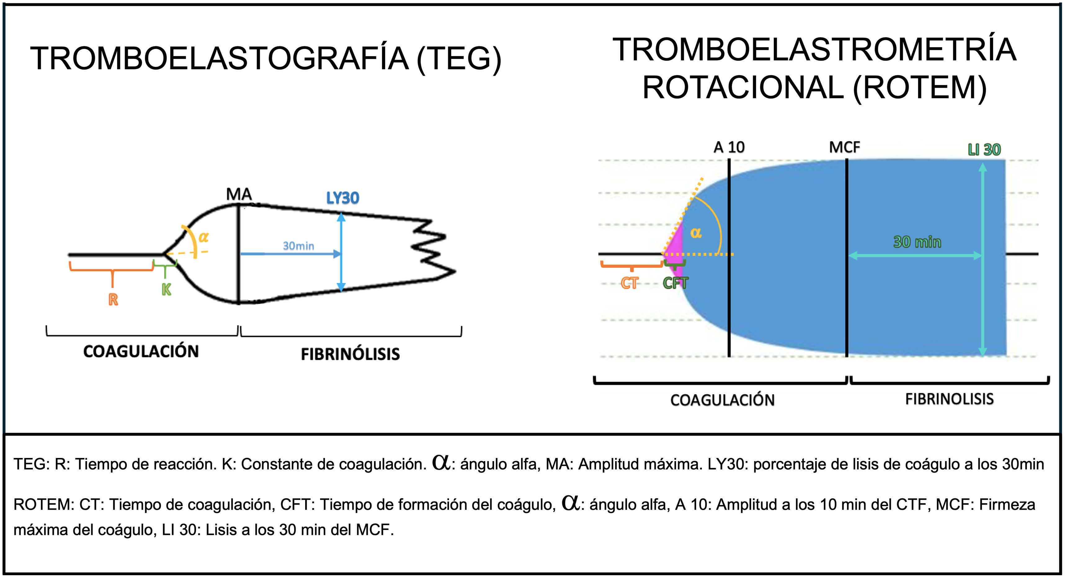 Teg Rotem Machine Alteraciones de la coagulación en los pacientes con hepatopatía crónica ...